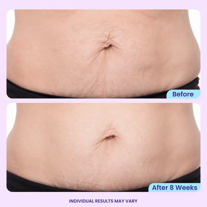 BBOJI™Tighten & Smooth Belly Cream