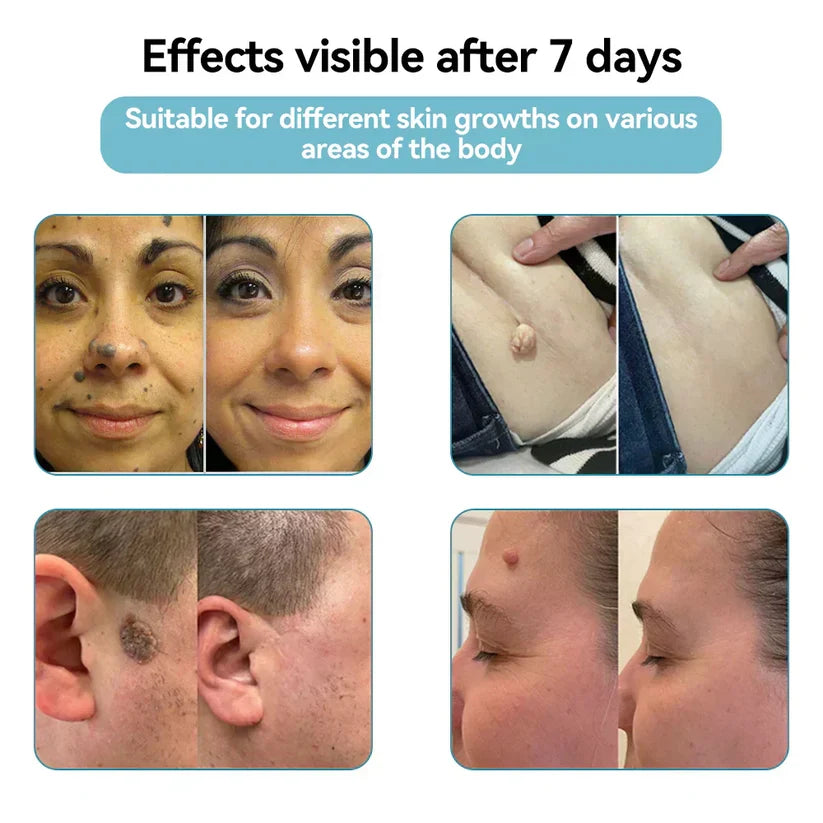 Deep Delivery of Active Skin ingredients