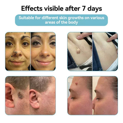 Deep Delivery of Active Skin ingredients