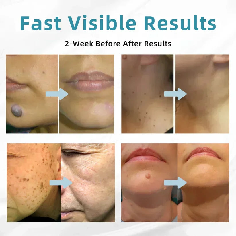 Deep Delivery of Active Skin ingredients