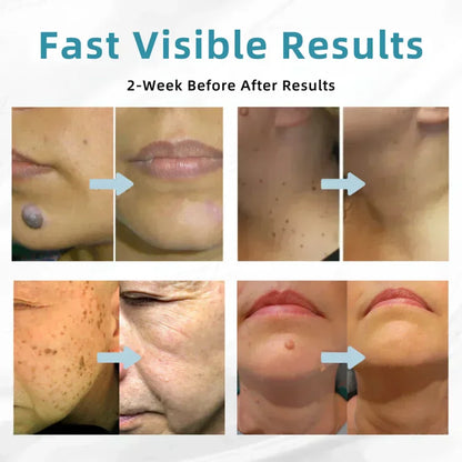 Deep Delivery of Active Skin ingredients