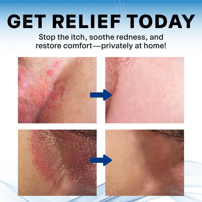 BBOJI® Scrotum Itchy Treatment Cream