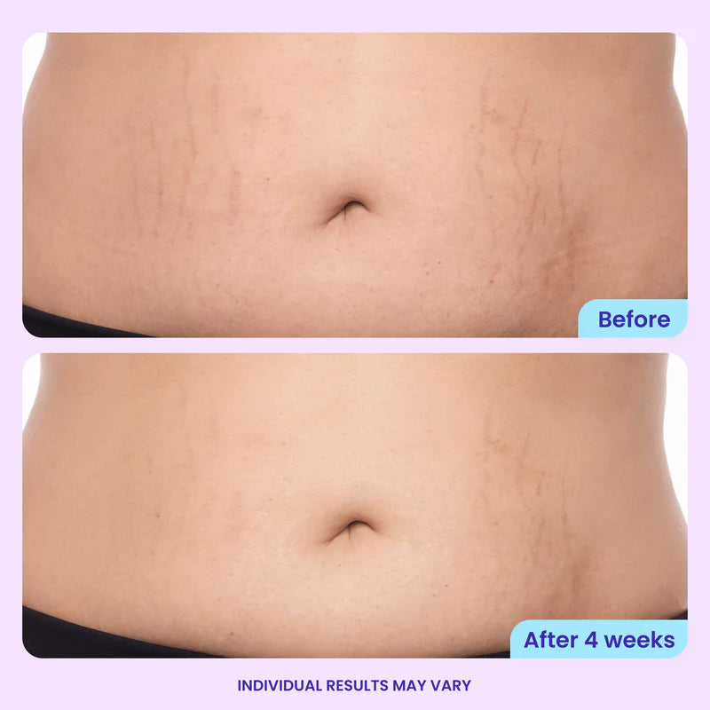 BBOJI™Tighten & Smooth Belly Cream