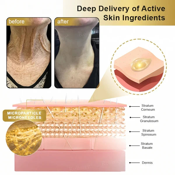 Deep Delivery of ActiveSkin Ingredients
