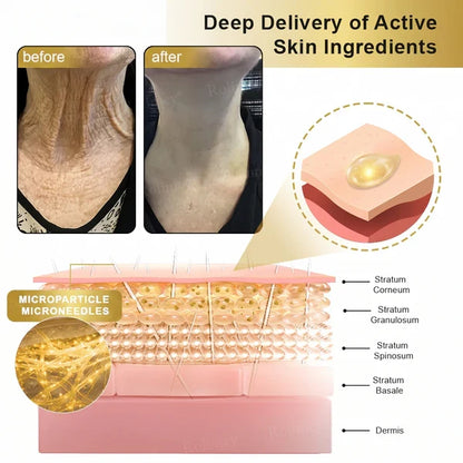 Deep Delivery of ActiveSkin Ingredients