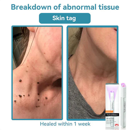 Deep Delivery of Active Skin ingredients