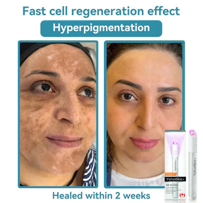 Deep Delivery of Active Skin ingredients
