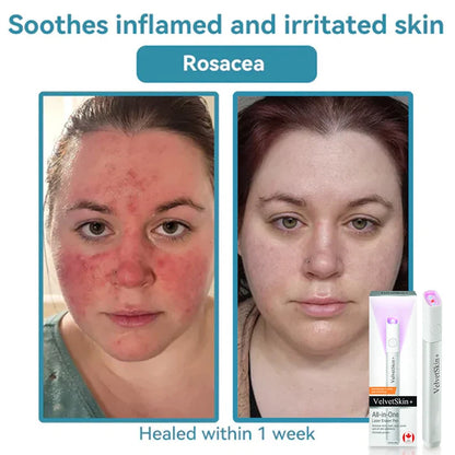 Deep Delivery of Active Skin ingredients