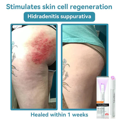 Deep Delivery of Active Skin ingredients